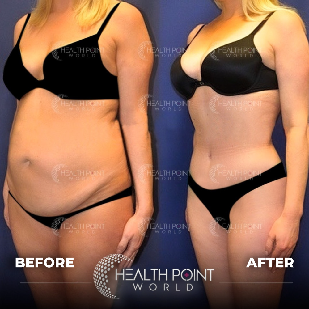 Clinic Results Gallery